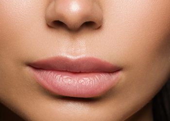 augmentare buze cu laser